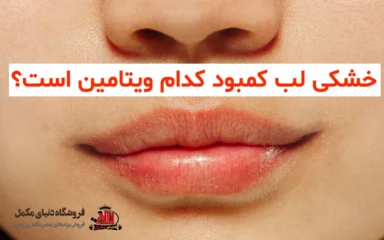 خشکی لب کمبود کدام ویتامین است؟