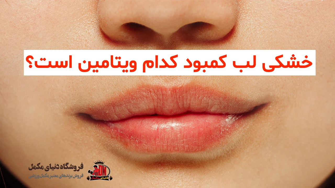 خشکی لب کمبود کدام ویتامین است؟