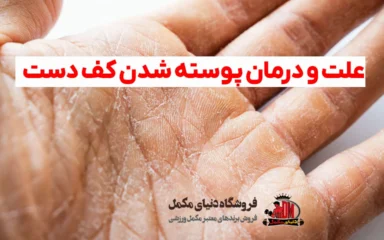 علت و درمان پوسته شدن کف دست
